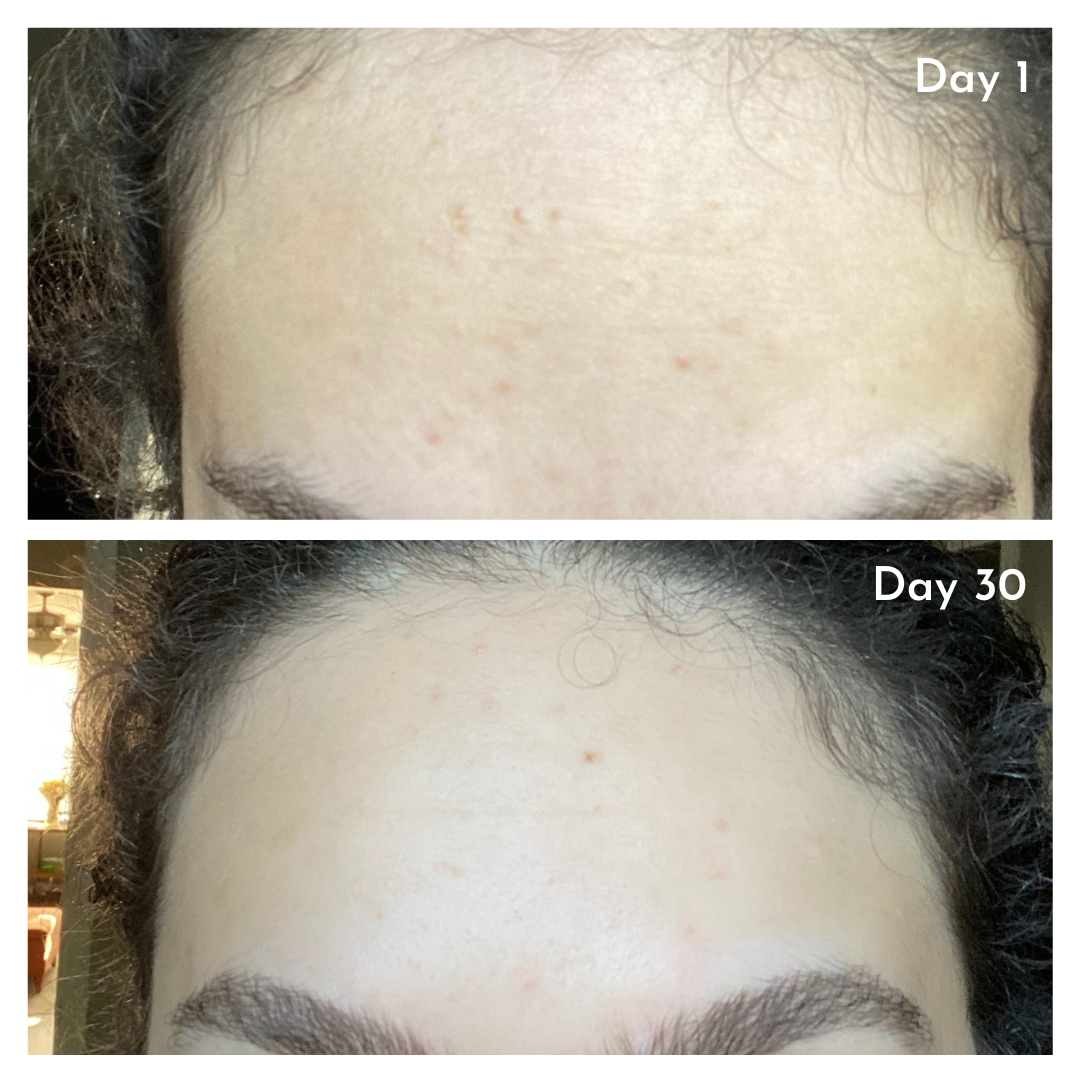 30 day before and after picture