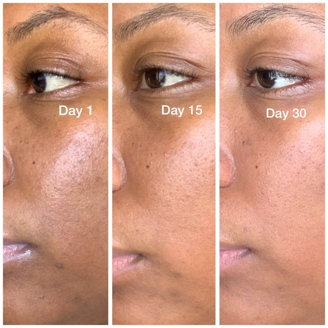 One to 30 day before and after pictures
